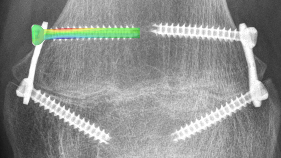 Biomedical Development